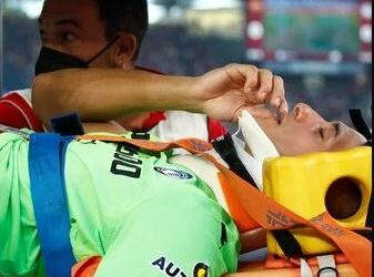 Musso fue operado de la fractura en el maxilar derecho