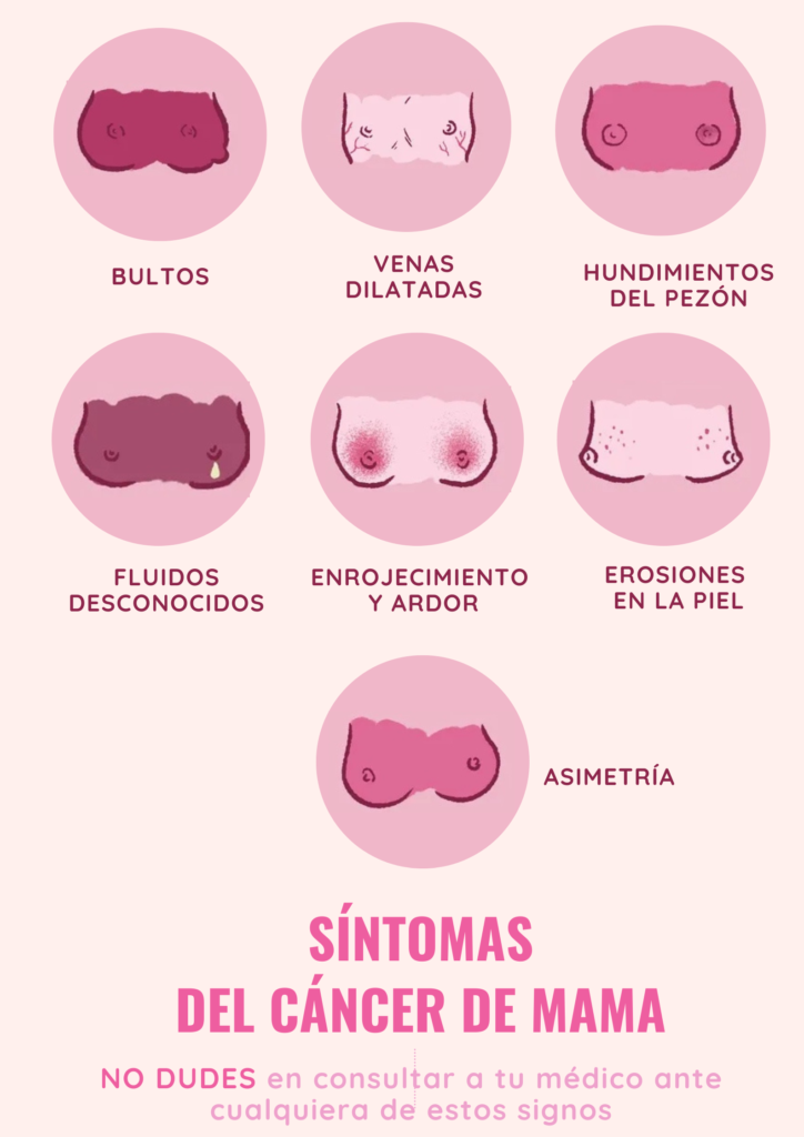 Mujeres mastectomizadas viven una odisea para validar su derecho a una reconstrucción mamaria