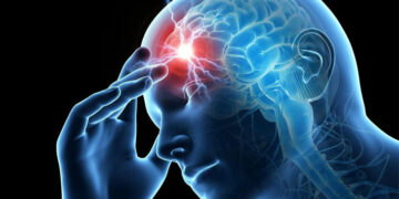Identifican cuatro formas de evolución del dolor de cabeza