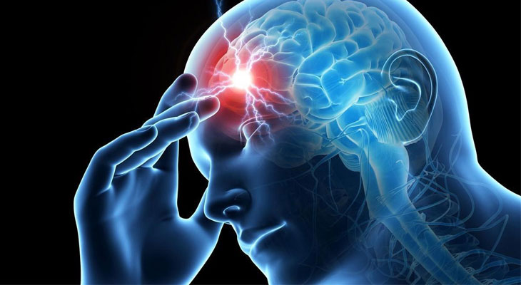Identifican cuatro formas de evolución del dolor de cabeza