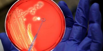 Las infecciones bacterianas son la segunda causa de muerte en el mundo