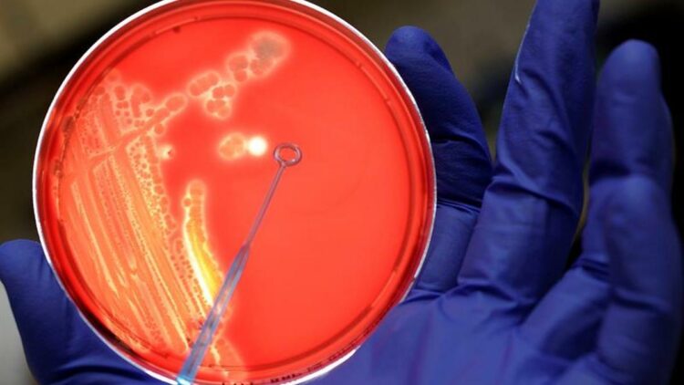 Las infecciones bacterianas son la segunda causa de muerte en el mundo