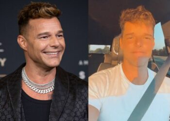 Ricky Martin levanta sospechas de “retoques” por la nueva apariencia de su rostro