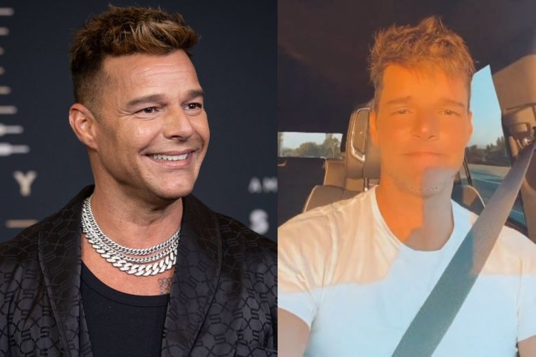 Ricky Martin levanta sospechas de “retoques” por la nueva apariencia de su rostro