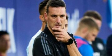 Los “tocados” para la Copa