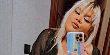 More Rial se realizó una tres cirugías estéticas en menos de un mes y así luce ahora