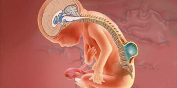 Espina bífida: cómo es la cirugía fetal que busca frenar el daño