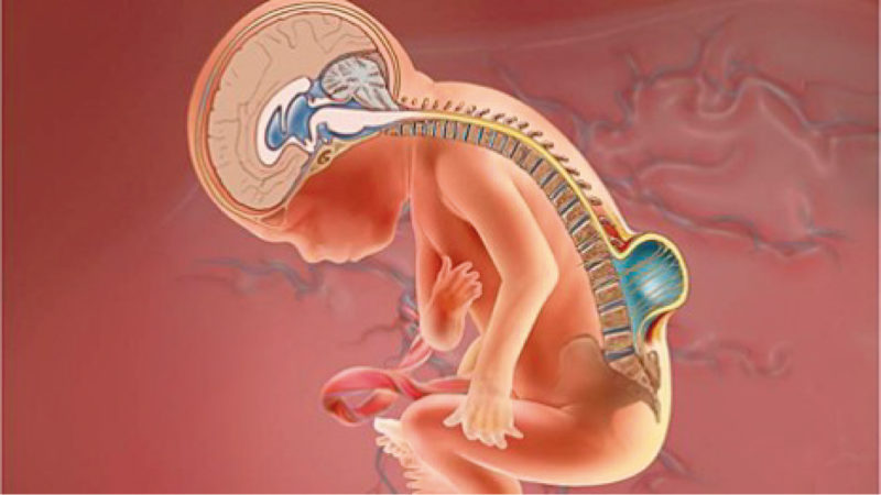 Espina bífida: cómo es la cirugía fetal que busca frenar el daño