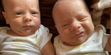 Se le mezclaron los gemelos de 45 días, no reconoce cuál es cuál y se volvió viral