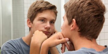 La caída de cabello, una problemática que cada vez es más consultada por jóvenes