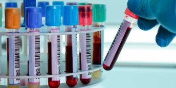 Recibió el diagnóstico de otra persona y pensó que tenía cáncer