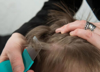 ¿Vuelan? ¿Saltan? Mitos y fakes en torno a los piojos