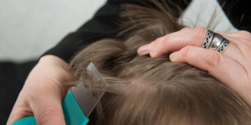 ¿Vuelan? ¿Saltan? Mitos y fakes en torno a los piojos