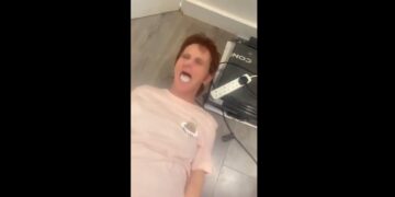 Compró una máquina para adelgazar, se descontroló y le hizo bailar la dentadura dentro de la boca