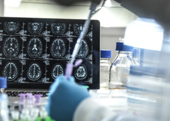 Un fármaco frenó la progresión del Alzheimer un 35% en un ensayo