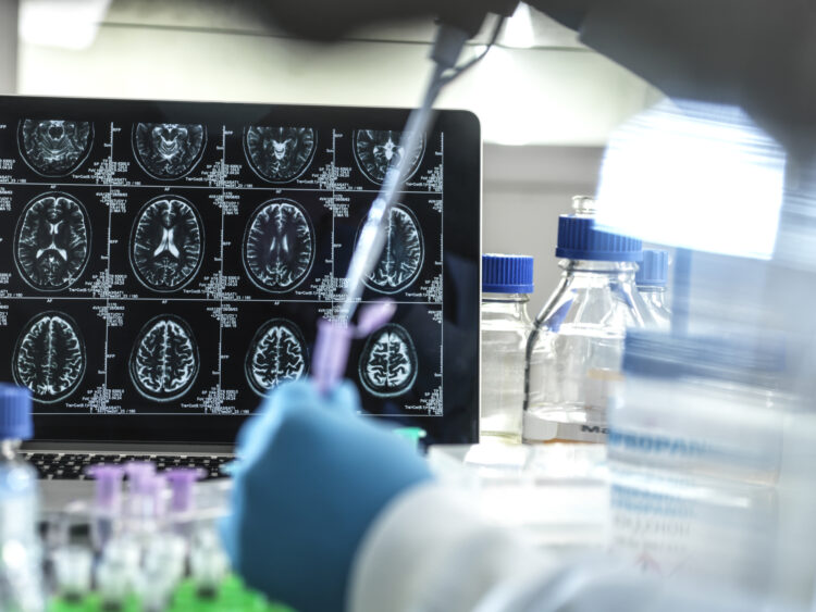 Clinical research to develop a possible cure for Alzheimers and dementia in the lab.
