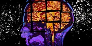 Alzheimer: una terapia logró reducir la pérdida de memoria