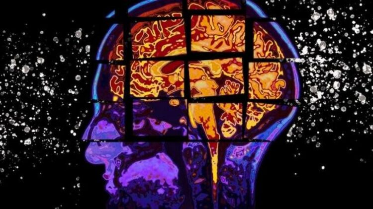 Alzheimer: una terapia logró reducir la pérdida de memoria