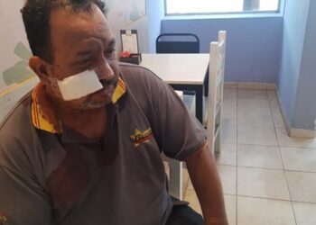 Dos ladrones le desfiguraron la cara a un taxista en Bella Vista