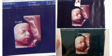 Acusaron a una clínica de entregar la misma foto de una ecografía 5D a distintas embarazadas