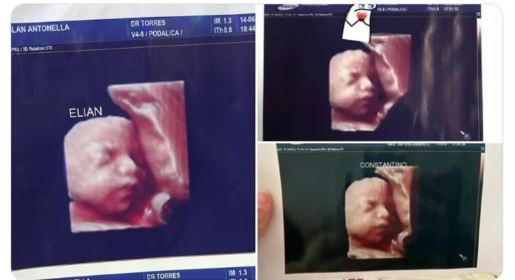 Acusaron a una clínica de entregar la misma foto de una ecografía 5D a distintas embarazadas Acusaron a una clínica de entregar la misma foto de una ecografía 5D a distintas embarazadas