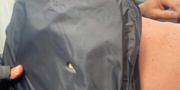 Un agente de la Policía resultó herido por un impacto de arma de fuego y piedrazos de vecinos