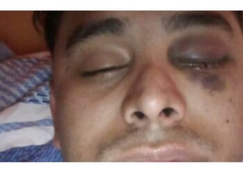 Un joven se atrasó en el pago del alquiler y perdió un ojo tras recibir un culatazo del dueño