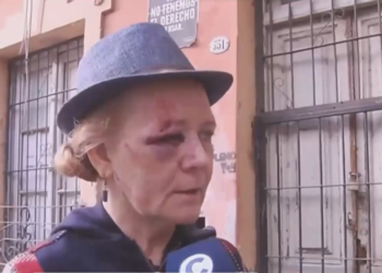 Una vecina de Güemes asegura haber sido agredida a puños por una «naranjita»