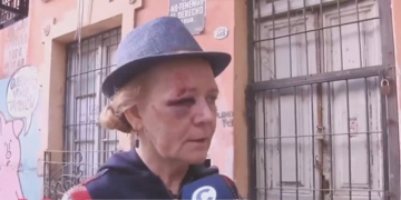 Una vecina de Güemes asegura haber sido agredida a puños por una «naranjita»
