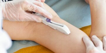 La distribución de implantes subdérmicos creció más de 1.500% en ocho años