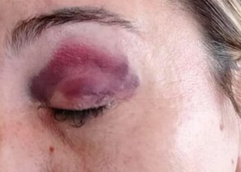 Una periodista sufrió una agresión «no intencional» en la previa de Talleres-Instituto