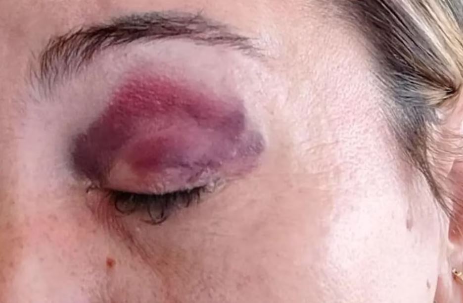 Una periodista sufrió una agresión "no intencional" en la previa de Talleres-Instituto