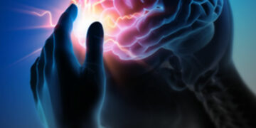 El ACV es la principal causa de discapacidad a nivel mundial