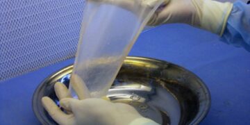 El Banco Multitejidos alcanzó las 500 donaciones de placenta