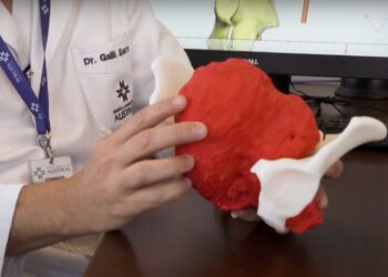 Destacan la tecnología 3D aplicada en cirugías como un avance extraordinario