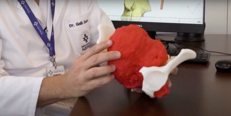 Destacan la tecnología 3D aplicada en cirugías como un avance extraordinario