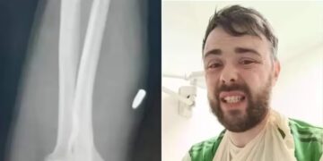 Iba a patear un “corner”, pero le pegaron un tiro y terminó internado