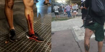 Advierten por los periodistas heridos en las protestas