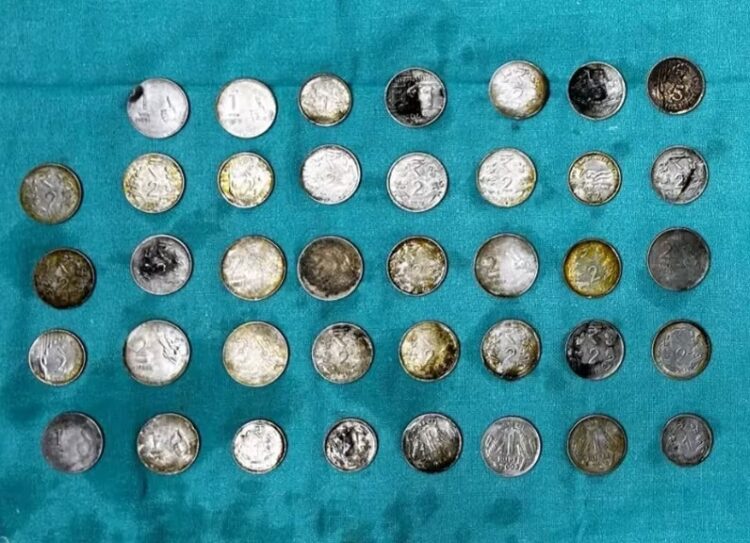 Se comió 39 monedas y 37 imanes para absorber sus nutrientes, pero terminó en el quirófano de urgencia