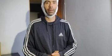 Siete asaltantes los atacaron con piedras, palos y cuchillos