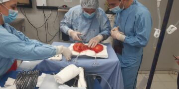 El Hospital de Urgencias es líder en procuración de órganos