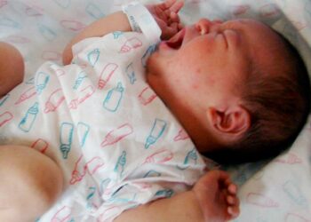 Detectan por año unos 60 recién nacidos expuestos al chagas