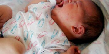 Detectan por año unos 60 recién nacidos expuestos al chagas