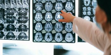 La importancia del cuidado preventivo del cerebro y las claves para mantenerlo activo