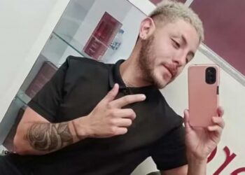 Falleció el joven cordobés que contrajo viruela del mono en México