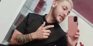 Falleció el joven cordobés que contrajo viruela del mono en México