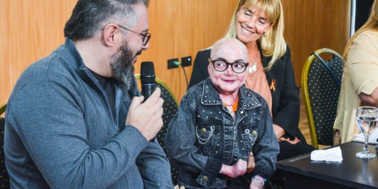 Día Mundial de la Piel de Cristal: Julieta contó cómo es vivir con esta enfermedad