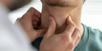 En Argentina se diagnostican más de 4.000 nuevos casos de cáncer de tiroides cada año