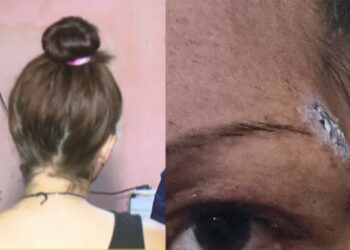 Una mujer denunció que su pareja intentó asfixiarla