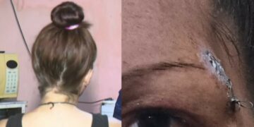 Una mujer denunció que su pareja intentó asfixiarla